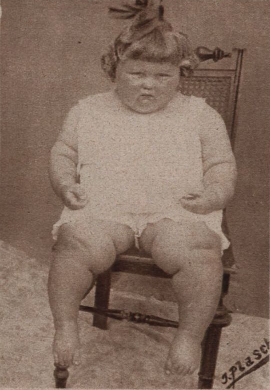 Barbara "Wetti" Nissler im Jahr 1926: 2 Jahre und 6 Monate alt, 90 cm, 38 kg